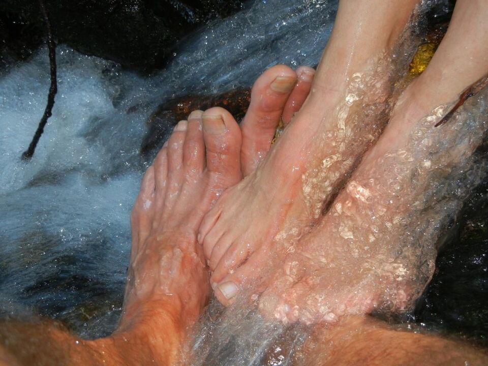 Mycose des ongles des jambes